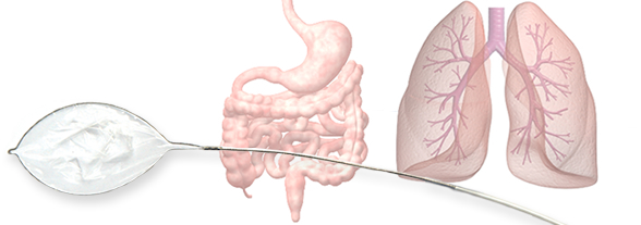 X-Trac für Gastroenterologie